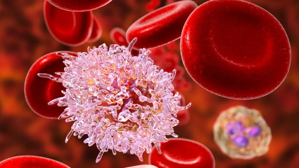 leucemia